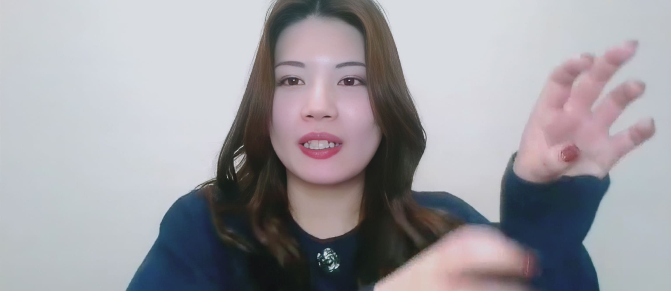 なぜ、東京海上日動だったのか